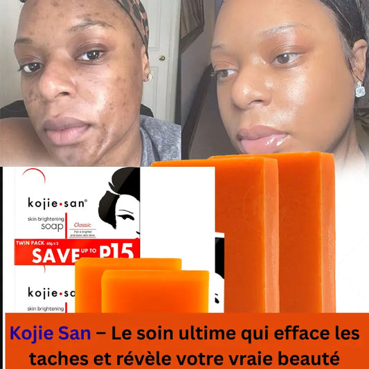 Kojie San – Le savon d’excellence des femmes élégantes et des hommes exigeants : efface les taches et révèle la vraie beauté